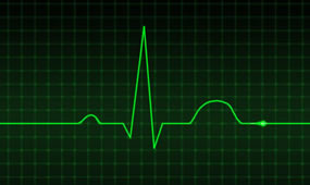 ECG (Eletrocardiograma)